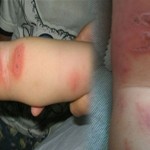 ดูแลลูกน้อย