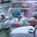 การคลอด