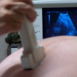 ดูแลครรภ์มารดา