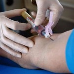 แม่ท้องอึ้ง เจาะเลือดออกมาเป็น สีขาว ทั้งถุง เพราะเหตุนี้ ดูแลครรภ์มารดา