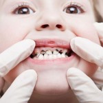 การป้องกันโรค