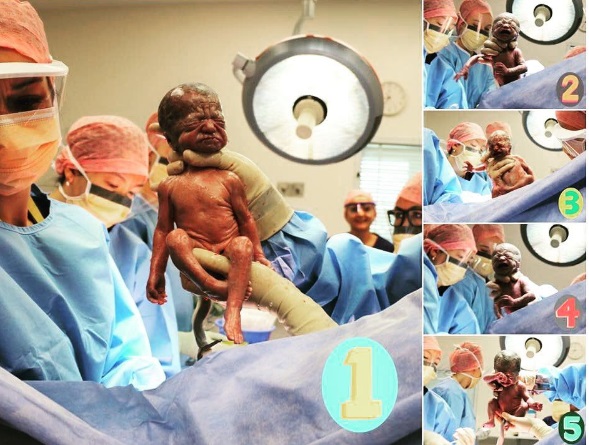 ความน่ารัก5แฝด