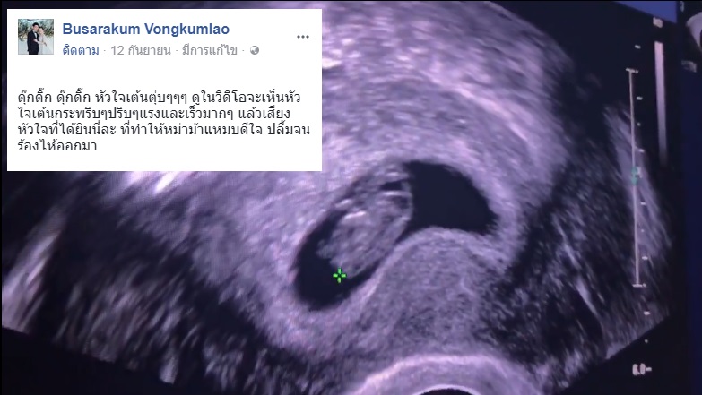 แชร์ประสบการณ์เตรียมตัวก่อนมีลูก