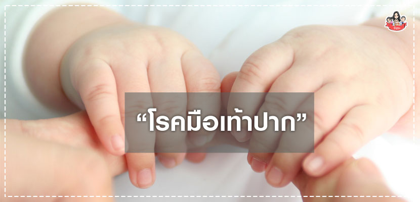 มือเท้าปาก
